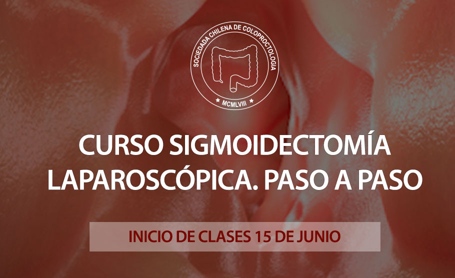 Curso Sigmoidectomía Laparoscópica. Paso a Paso