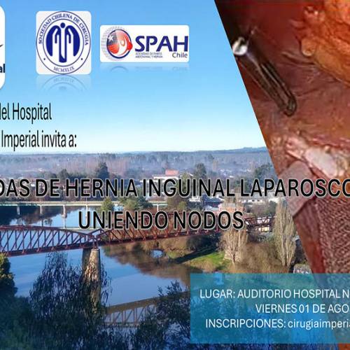 Jornadas de hernia Inguinal Laparoscopica UNIENDONOS
