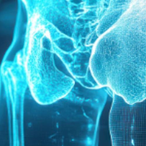 Curso Neuromodulación Sacra