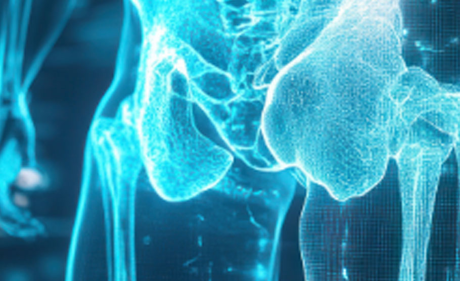 Curso Neuromodulación Sacra