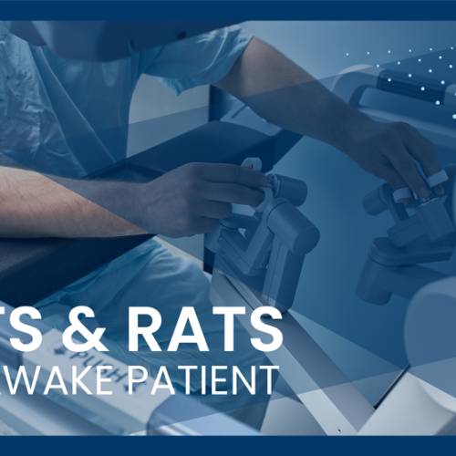 VATS & RATS AWAKE PATIENT – Oncological Thoracic Surgery